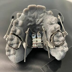 TadGuide Surgical guides for microimplants  30.09-1.10.2023